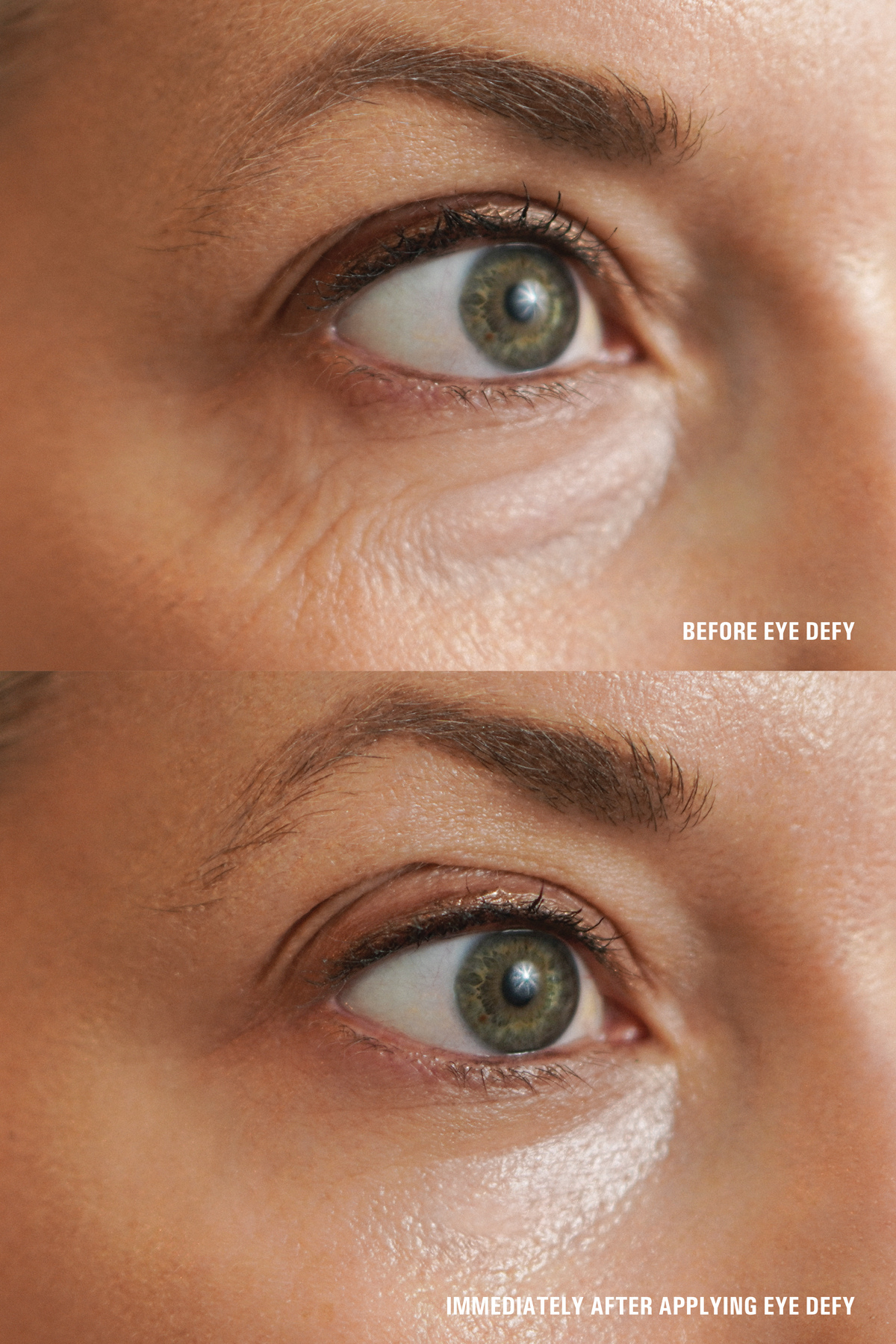 Eye Defy – Goldfaden MD eye-defy-goldfaden-md